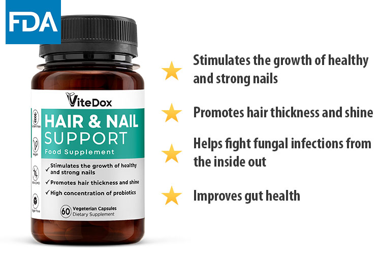 ViteDox Hair & Nail Support | Food Supplement